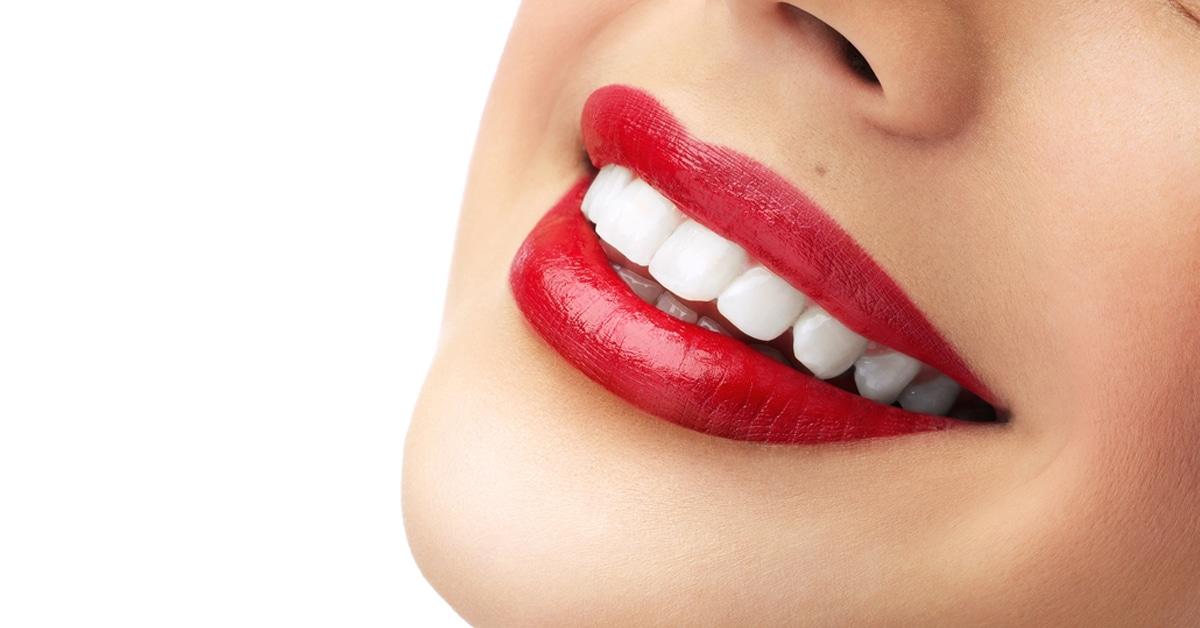 تجميل الاسنان