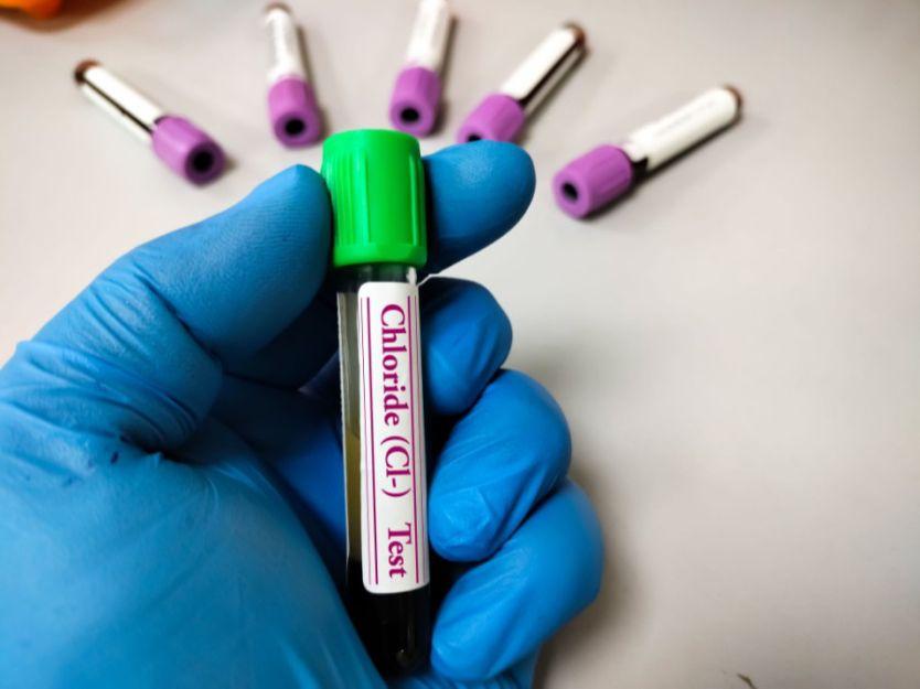 Gout Test Gout Test Analysis
