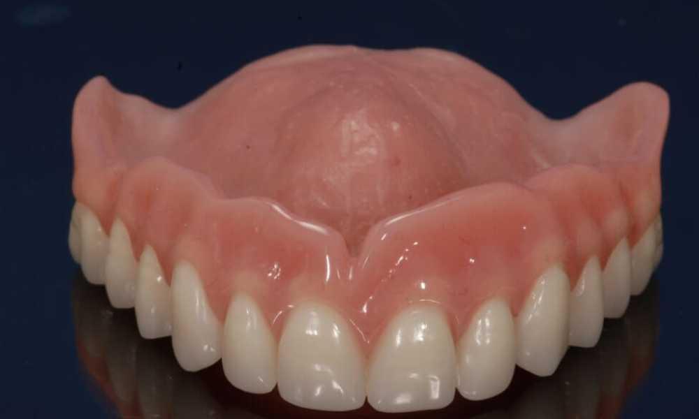 Cosmetic Dental Restorations