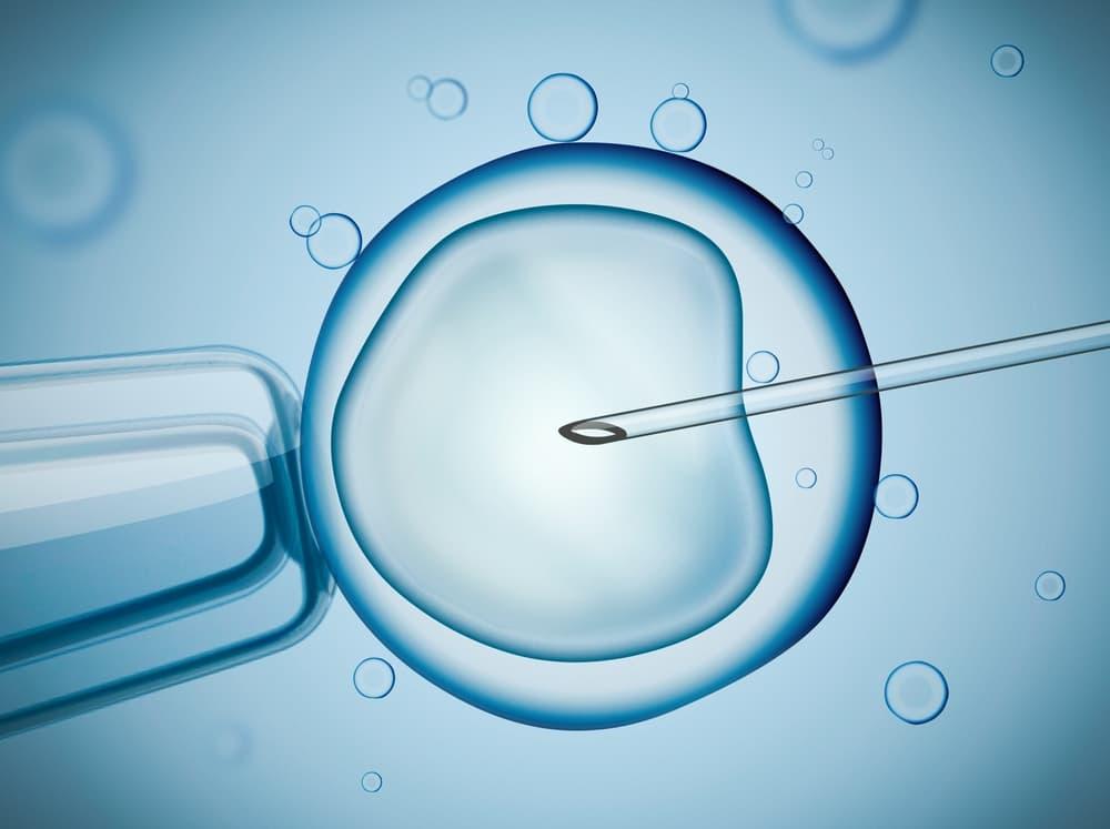 ICSI Treatment Procedure
