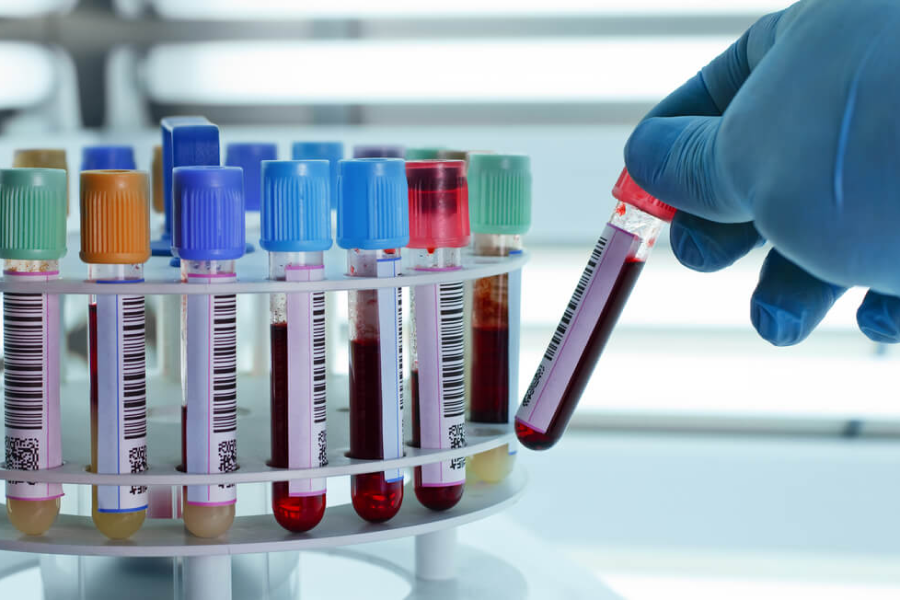Medical laboratory in El Shorouk City Al Noor Lab tests