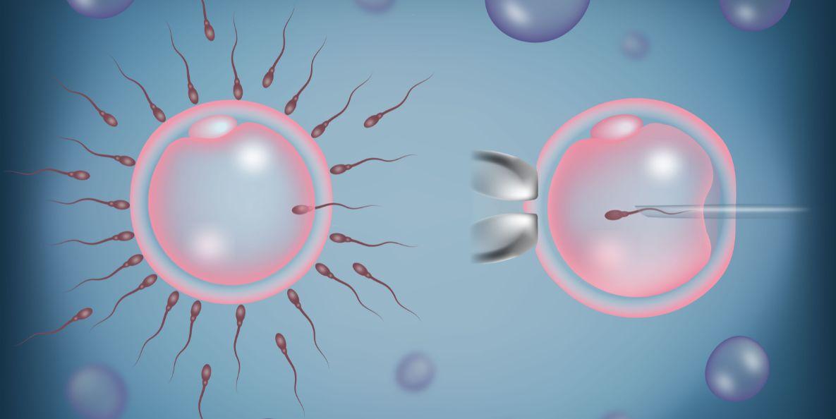 IVF Treatment