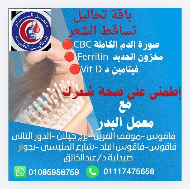تساقط الشعر