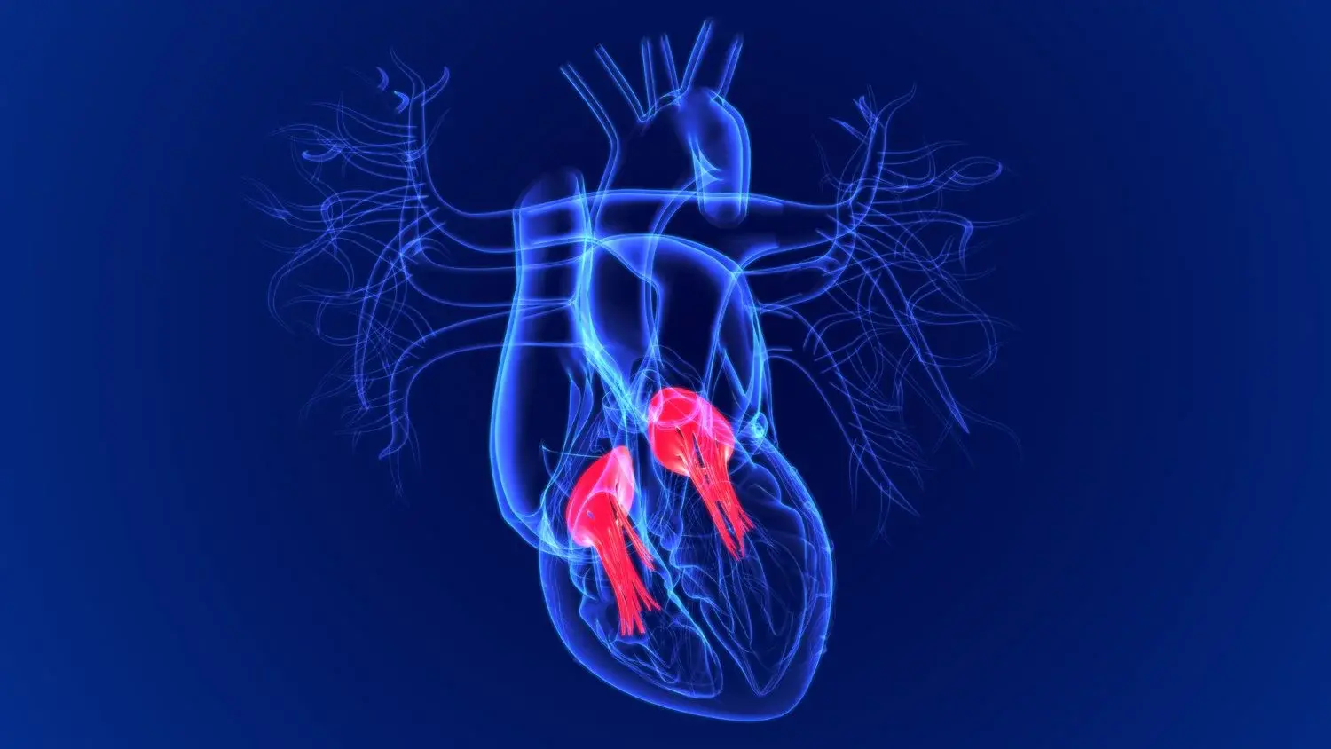 إصلاح واستبدال الصمام المترالي بدون جراحة مفتوحة | التدخل المحدود في القلب
