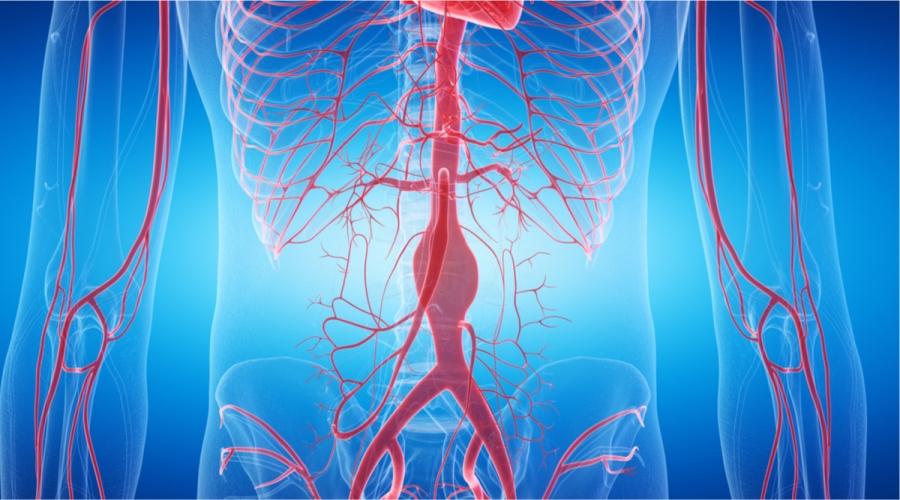 Aortic aneurysm surgery