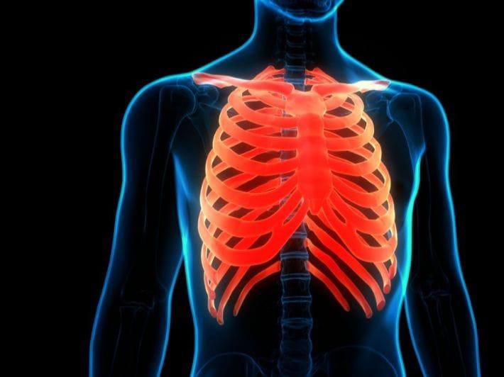 Chest wall injury causes rib fractures