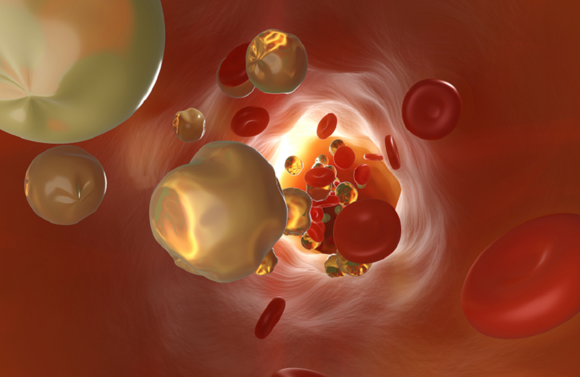 أدوية الكوليسترول تساعد في حماية الدماغ لدى مرضى السرطان