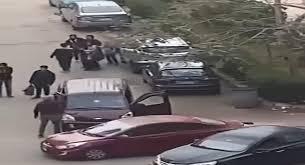 تطورات الحالة الصحية لمصاب واقعة قطع اليد بقرية أتميدة بالدقهلية بعد جراحة دقيقة