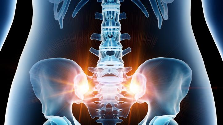 التهاب مفصل الحوض