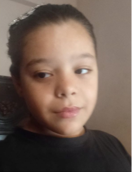 الطفلة هاجر بعد التعرض للتعذيب في الخصوص