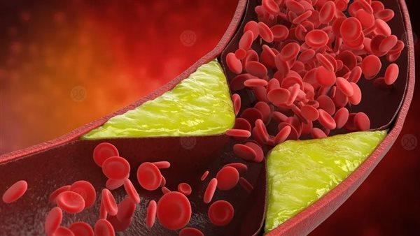 المكملات الغذائية من المغنيسيوم والزنك تحسن الكوليسترول وصحة القلب