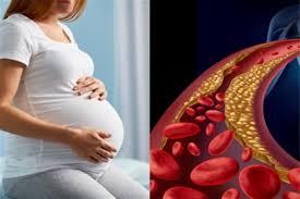 امرأة حامل تجري فحص الكوليسترول ضمن الفحوصات الطبية قبل الحمل