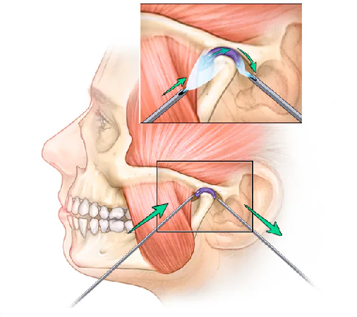 Jaw and Facial Surgery Jaw and Facial Surgery