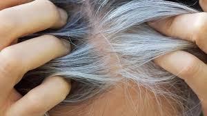 الشيب والوقاية الطبيعية من سرطان الجلد