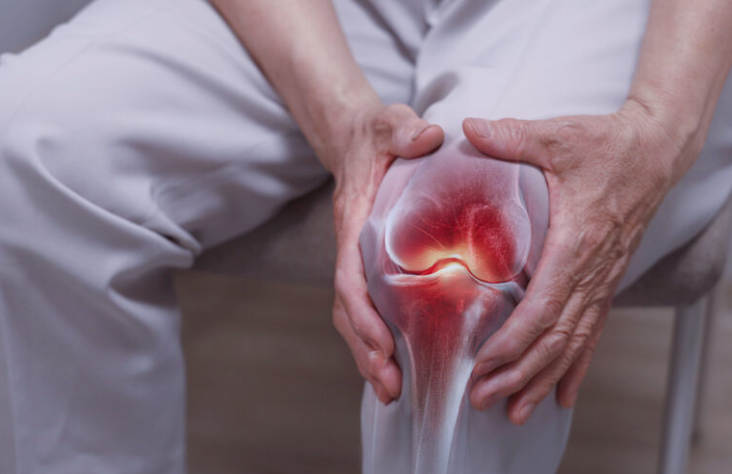 Medical assessment for knee osteoarthritis and non-surgical joint pain treatment