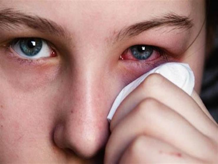 Iritis in children symptoms and causes