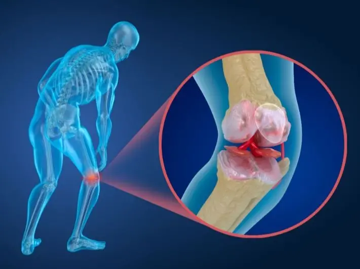 علاج خشونة المفاصل بدون جراحة في الجيزة