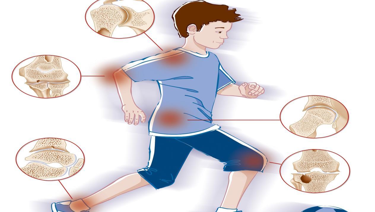 Rheumatology and Joint Specialist in New Cairo Juvenile arthritis and morning joint stiffness in children