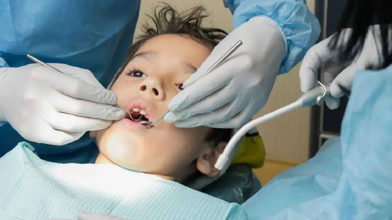 العناية بأسنان الأطفال والوقاية من التسوس في مركز A Plus لطب الأسنان بكفر الشيخ