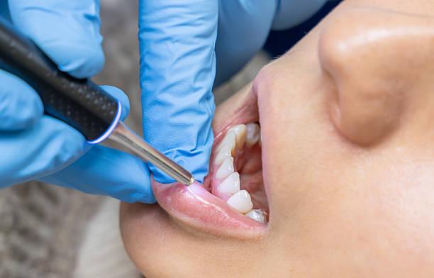 Laser gum treatment and periodontal care