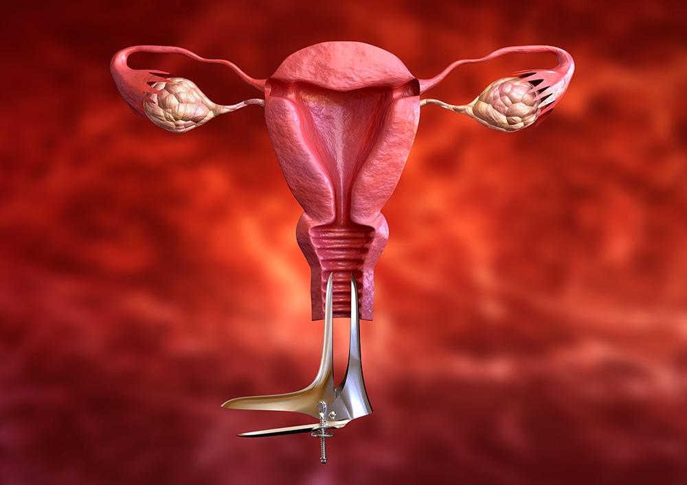 Early Cervical Tumor Screening Early cervical tumor screening and Pap smear examination