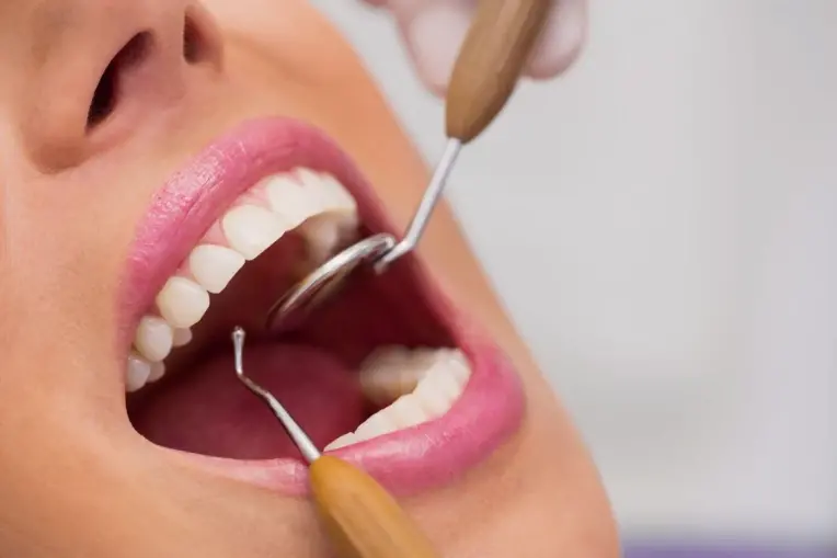 دكتور تجميل الأسنان في الشرقية