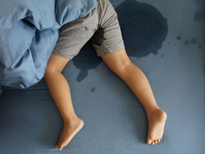 Urinary incontinence treatment for children with Dr. Mohamed Rabie in Ismailia