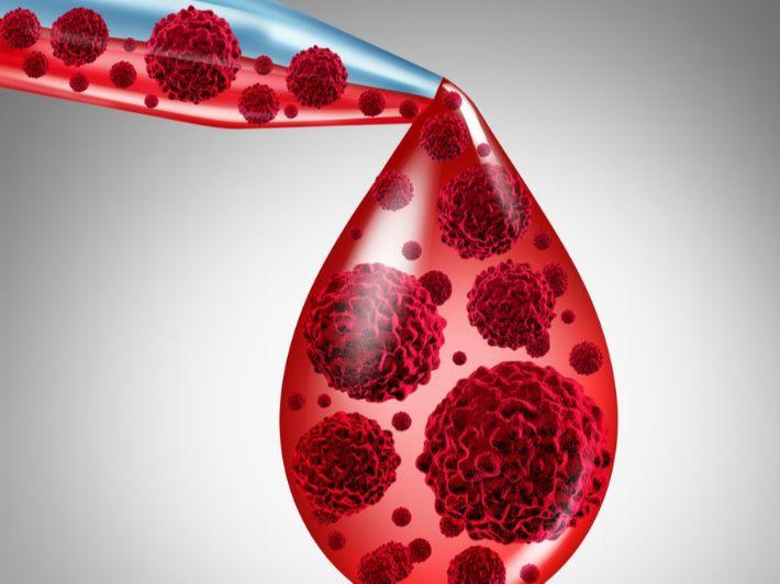 Blood Cancer: Causes and Risk Factors Medical illustration related to blood cancer causes and risk factors