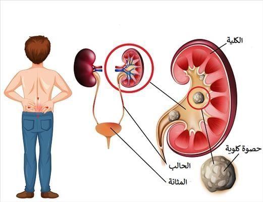 الدكتور أحمد عاطف خلاف استشاري جراحة الكلى والمسالك وتفتيت الحصوات بالليزر