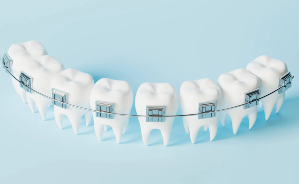 Orthodontic treatment in Minya Al Qamh Sharqia