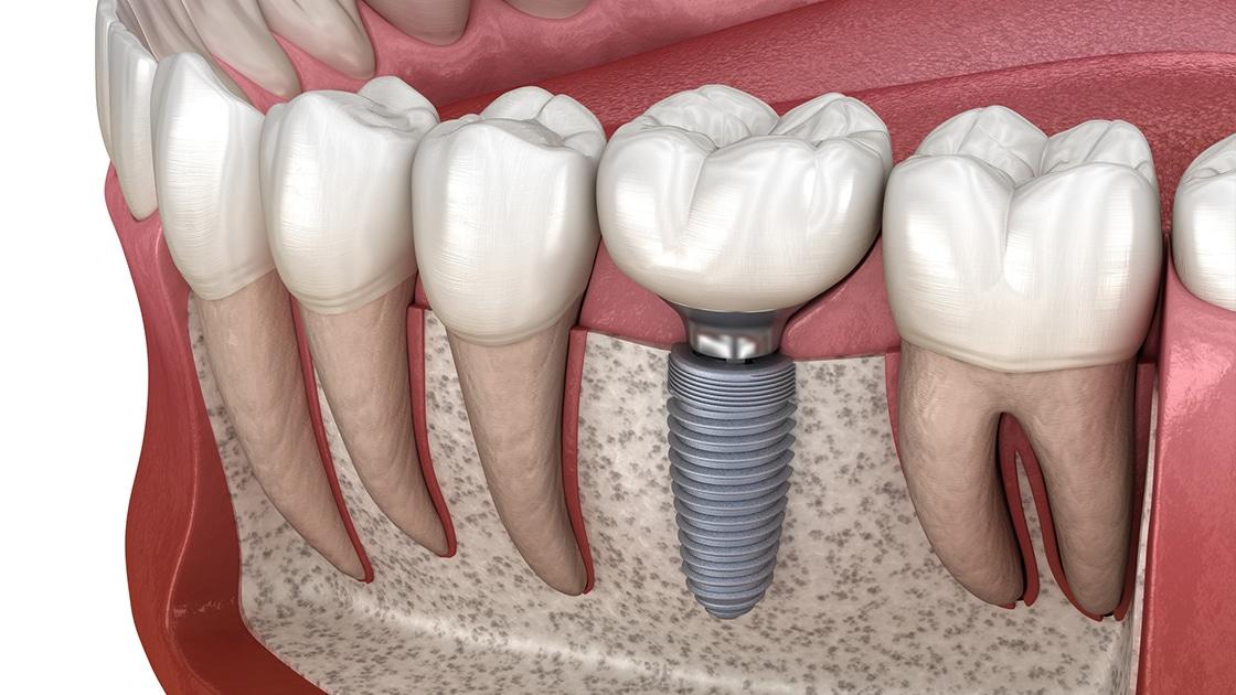 الدكتور أشرف لطفي الجمل استشاري تجميل وزراعة الأسنان وجراحة الفكين