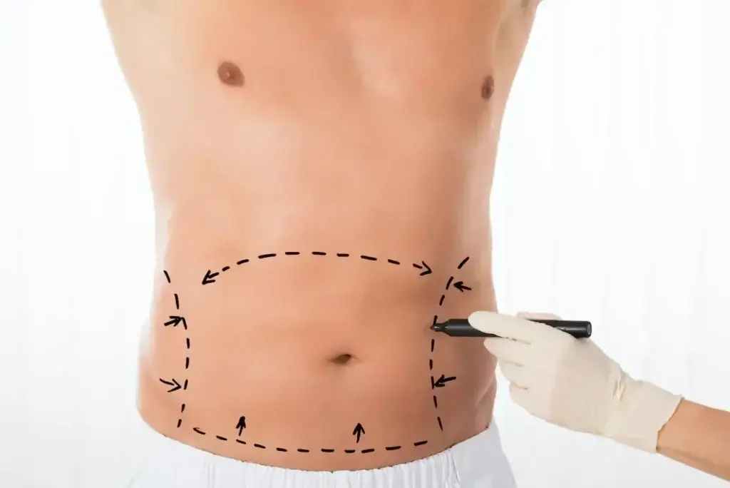 الدكتور أحمد لطفي الجمل استشاري جراحة التجميل ونحت القوام بالفيزر بالمهندسين