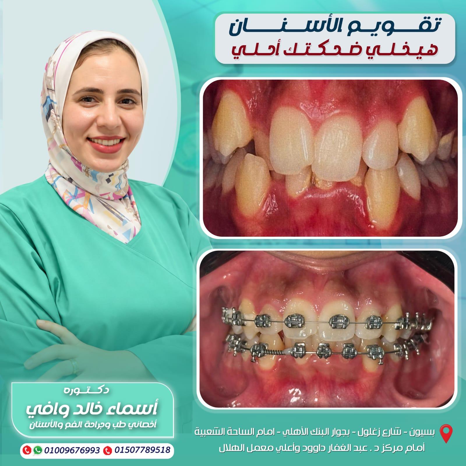 تقويم الأسنان في الغربية