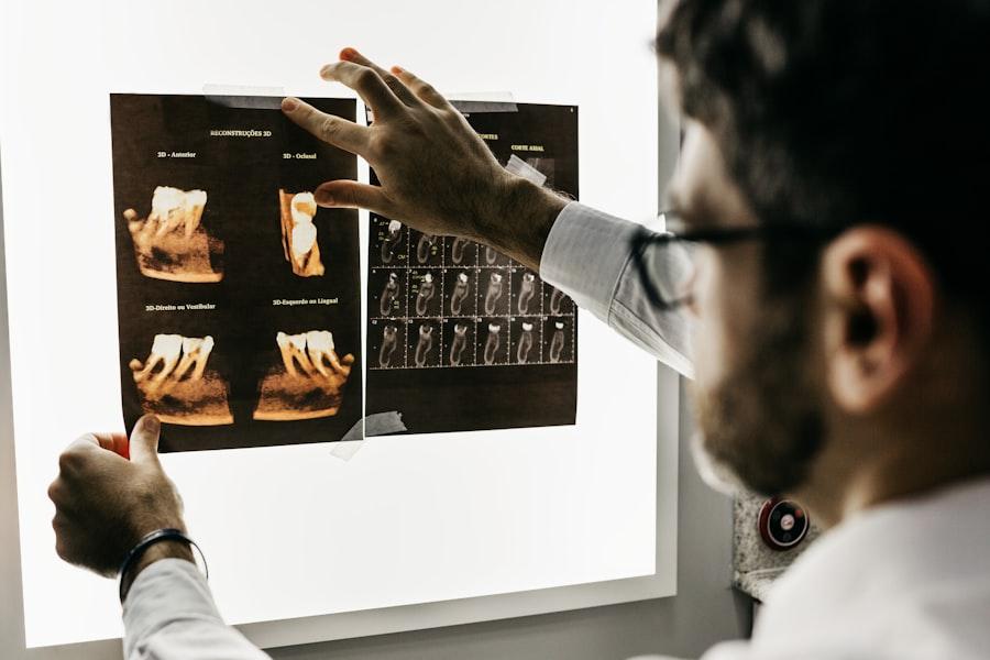 تقويم وتجميل الأسنان في عيادات بريتش بروكير إشراف دكتورة هبة البتانوني بالتجمع الخامس