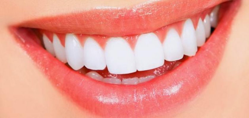 تجميل اسنان في مصر كونكت