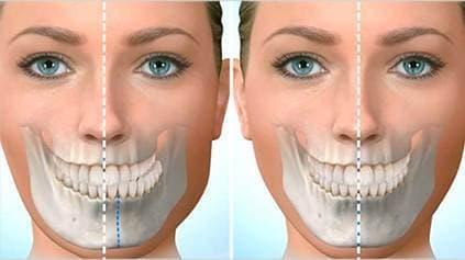Jaw and Facial Surgery Jaw and Facial Surgery