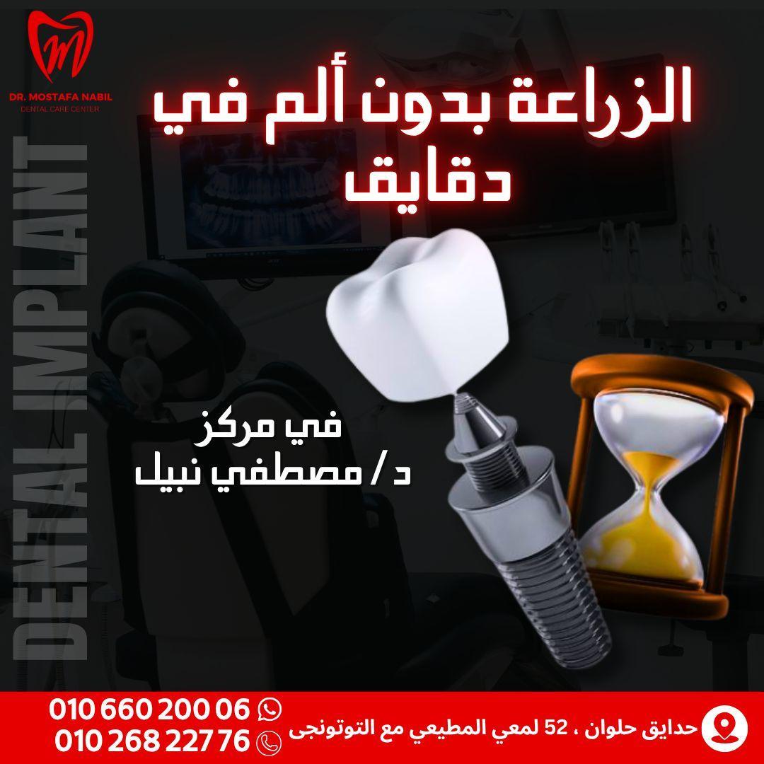 Dental Implants Dental Implants