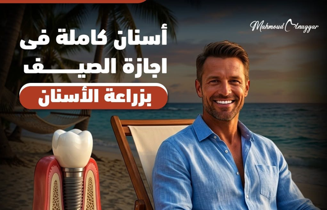 زراعة الأسنان الفورية