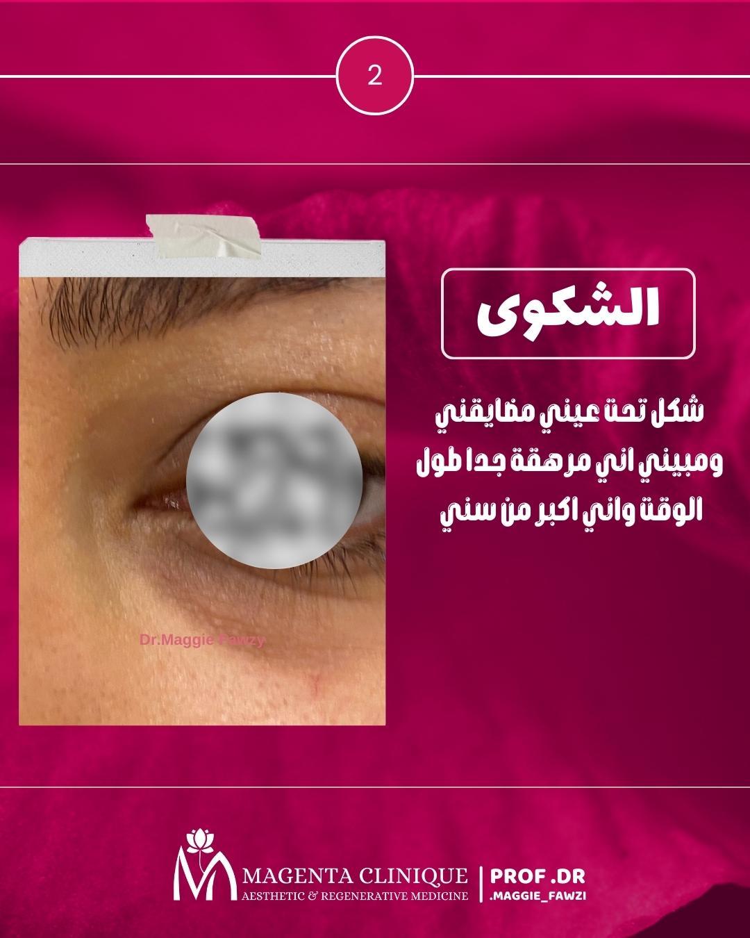 شكاوي مشاكل العين