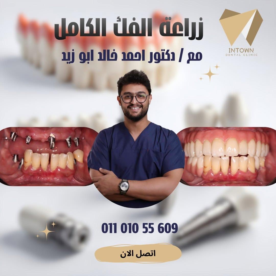 زراعه الاسنان